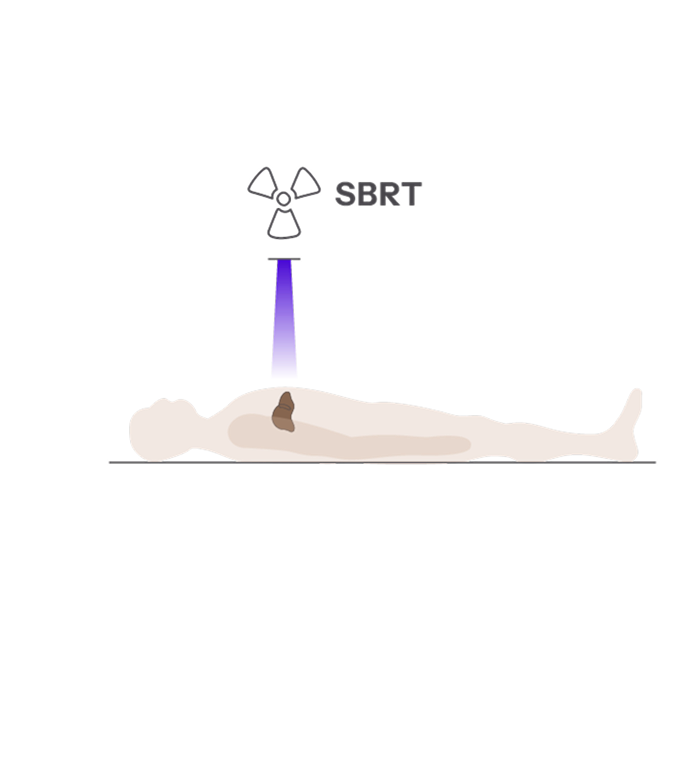For Patients with 1–3 Tumors